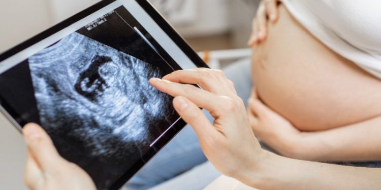 Antiabortion group’s ‘Baby Olivia’ video may be required in some schools